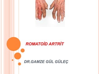ROMATOİD ARTRİT
DR.GAMZE GÜL ÜÇ
 
