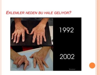 EKLEMLER NEDEN BU HALE GELIYOR?
 
