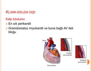 KLINIK-EKLEM DIŞI
Kalp tutulumu
 En sık perikardit
 Granülomatoz miyokardit ve buna bağlı AV ileti
bloğu
 