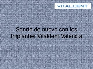 Sonríe de nuevo con los
Implantes Vitaldent Valencia
 