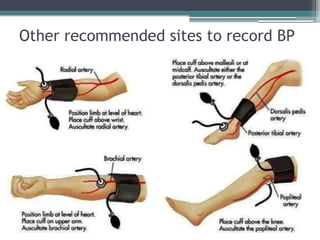 Sop for recording blood pressure | PDF