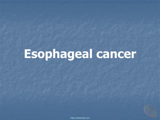 Еsophageal cancer
https://mbbshelp.com
 