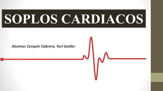 SOPLOS CARDIACOS
Alumno: Cerquín Cabrera, Yuri Guiller
 