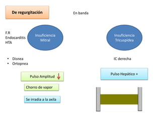 De regurgitación En banda
Insuficiencia
Mitral
Insuficiencia
Tricuspidea
F.R
Endocarditis
HTA
• Disnea
• Ortopnea
Chorro de vapor
Se irradia a la axila
Pulso Amplitud
IC derecha
Pulso Hepático +
 