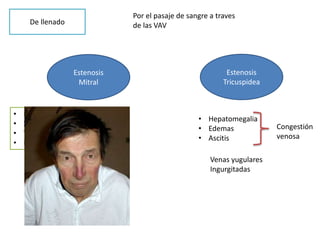 De llenado
Estenosis
Mitral
Estenosis
Tricuspidea
Por el pasaje de sangre a traves
de las VAV
• Disnea
• Hemoptisis
• Tos
• Fatiga muscular
• Hepatomegalia
• Edemas
• Ascitis
Congestión
venosa
Venas yugulares
Ingurgitadas
 