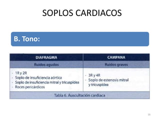 B. Tono:
• Alto.
• Medio.
• Bajo.
SOPLOS CARDIACOS
16
 