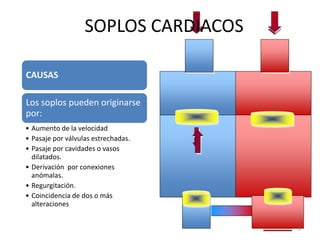 CAUSAS
Los soplos pueden originarse
por:
• Aumento de la velocidad
• Pasaje por válvulas estrechadas.
• Pasaje por cavidades o vasos
dilatados.
• Derivación por conexiones
anómalas.
• Regurgitación.
• Coincidencia de dos o más
alteraciones
SOPLOS CARDIACOS
4
 