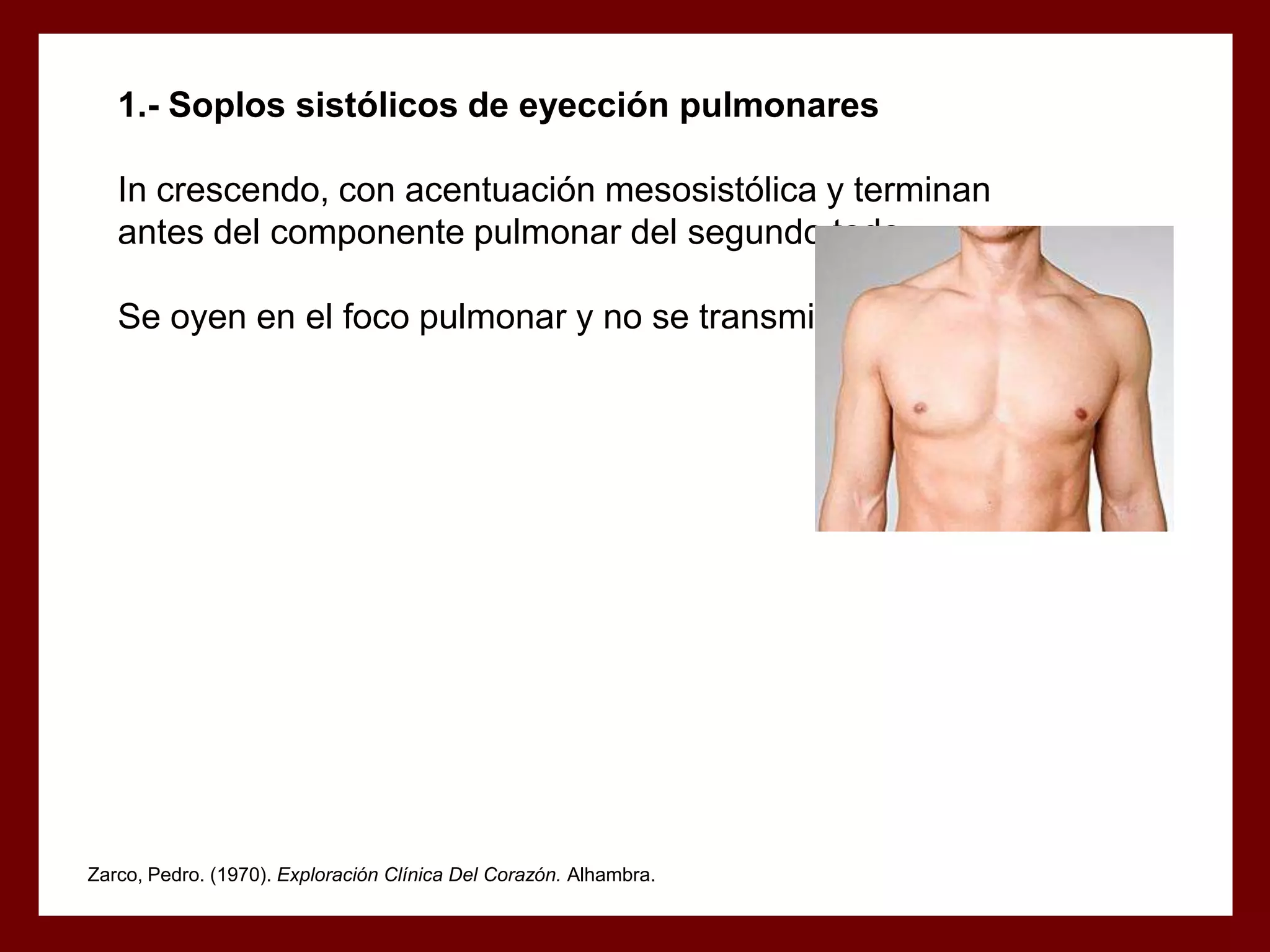 1.- Soplos sistólicos de eyección pulmonares
In crescendo, con acentuación mesosistólica y terminan
antes del componente pulmonar del segundo todo.
Se oyen en el foco pulmonar y no se transmiten a la punta

Zarco, Pedro. (1970). Exploración Clínica Del Corazón. Alhambra.

 