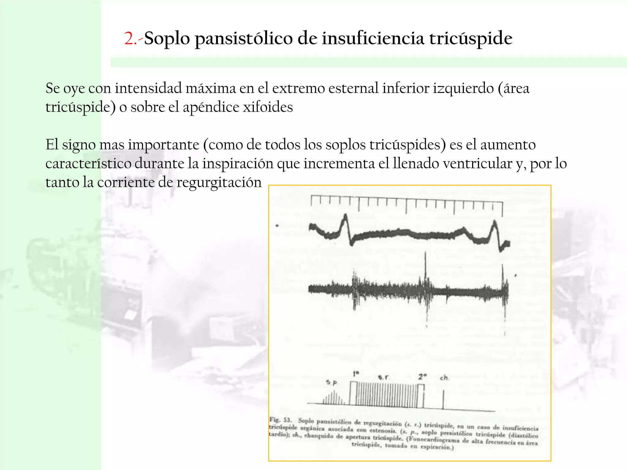2.-Soplo pansistólico de insuficiencia tricúspide
Se oye con intensidad máxima en el extremo esternal inferior izquierdo (área
tricúspide) o sobre el apéndice xifoides
El signo mas importante (como de todos los soplos tricúspides) es el aumento
característico durante la inspiración que incrementa el llenado ventricular y, por lo
tanto la corriente de regurgitación

 