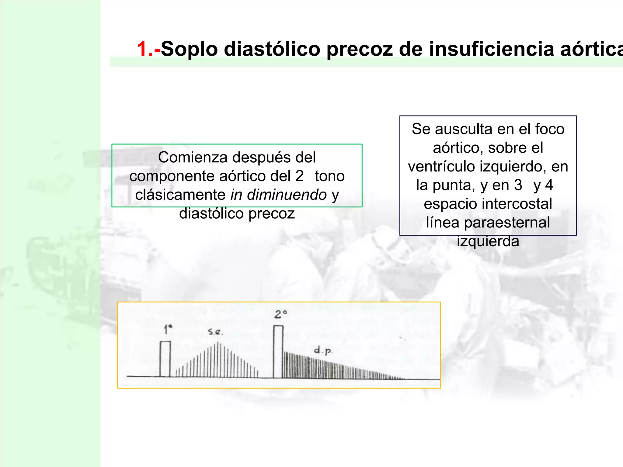 1.-Soplo diastólico precoz de insuficiencia aórtica

Comienza después del
componente aórtico del 2 tono
clásicamente in diminuendo y
diastólico precoz

Se ausculta en el foco
aórtico, sobre el
ventrículo izquierdo, en
la punta, y en 3 y 4
espacio intercostal
línea paraesternal
izquierda

 