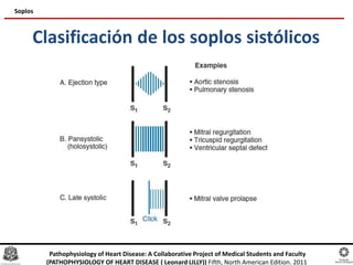 Clasificación de los soplos sistólicos
Soplos
Pathophysiology of Heart Disease: A Collaborative Project of Medical Students and Faculty
(PATHOPHYSIOLOGY OF HEART DISEASE ( Leonard LILLY)) Fifth, North American Edition. 2011
 