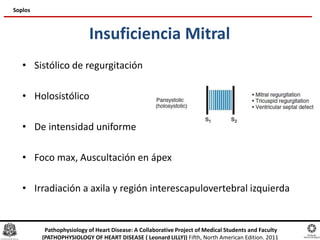 Insuficiencia Mitral
• Sistólico de regurgitación
• Holosistólico
• De intensidad uniforme
• Foco max, Auscultación en ápex
• Irradiación a axila y región interescapulovertebral izquierda
Soplos
Pathophysiology of Heart Disease: A Collaborative Project of Medical Students and Faculty
(PATHOPHYSIOLOGY OF HEART DISEASE ( Leonard LILLY)) Fifth, North American Edition. 2011
 