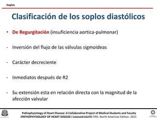 Clasificación de los soplos diastólicos
• De Regurgitación (insuficiencia aortica-pulmonar)
- Inversión del flujo de las válvulas sigmoideas
- Carácter decreciente
- Inmediatos después de R2
- Su extensión esta en relación directa con la magnitud de la
afección valvular
Soplos
Pathophysiology of Heart Disease: A Collaborative Project of Medical Students and Faculty
(PATHOPHYSIOLOGY OF HEART DISEASE ( Leonard LILLY)) Fifth, North American Edition. 2011
 