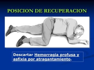 POSICION DE RECUPERACION




 Descartar Hemorragia profusa y
 asfixia por atragantamiento.
 