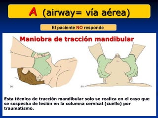 A (airway= vía aérea)
  Maniobra de tracción mandibular
                     El paciente NO responde

       Maniobra de tracción mandibular




Esta técnica de tracción mandibular solo se realiza en el caso que
se sospecha de lesión en la columna cervical (cuello) por
traumatismo.
 