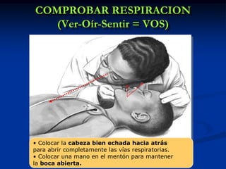 COMPROBAR RESPIRACION
   (Ver-Oír-Sentir = VOS)




• Colocar la cabeza bien echada hacia atrás
para abrir completamente las vías respiratorias.
• Colocar una mano en el mentón para mantener
la boca abierta.
 