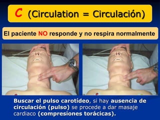 C   (Circulation = Circulación)

El paciente NO responde y no respira normalmente




   Buscar el pulso carotídeo, si hay ausencia de
   circulación (pulso) se procede a dar masaje
   cardiaco (compresiones torácicas).
 
