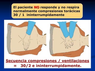El paciente NO responde y no respira
   normalmente compresiones torácicas
   30 / 1 ininterrumpidamente




Secuencia compresiones / ventilaciones
   = 30/2 e ininterrumpidamente.
 