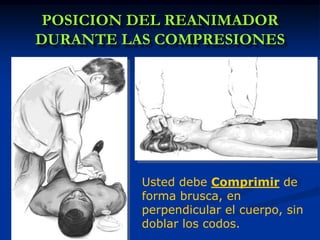 POSICION DEL REANIMADOR
DURANTE LAS COMPRESIONES




          Usted debe Comprimir de
          forma brusca, en
          perpendicular el cuerpo, sin
          doblar los codos.
 