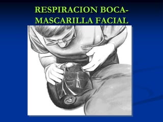 RESPIRACION BOCA-
MASCARILLA FACIAL
 