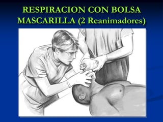 RESPIRACION CON BOLSA
MASCARILLA (2 Reanimadores)
 