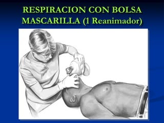 RESPIRACION CON BOLSA
MASCARILLA (1 Reanimador)
 