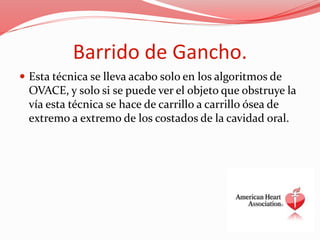 Barrido de Gancho.
 Esta técnica se lleva acabo solo en los algoritmos de
OVACE, y solo si se puede ver el objeto que obstruye la
vía esta técnica se hace de carrillo a carrillo ósea de
extremo a extremo de los costados de la cavidad oral.
 