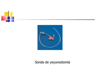 Sonda de yeyunostomía 