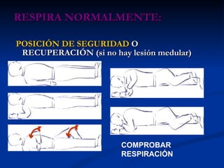 RESPIRA NORMALMENTE:  POSICIÓN DE SEGURIDAD  O RECUPERACIÓN (si no hay lesión medular) COMPROBAR  RESPIRACIÓN 