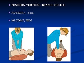 POSICION VERTICAL. BRAZOS RECTOS HUNDIR 4 - 5 cm 100 COMP/MIN 