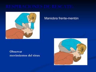 RESPIRACIONES DE RESCATE: Maniobra frente-mentón Observar movimientos del tórax 