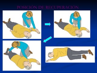 POSICIÓN DE RECUPERACIÓN 