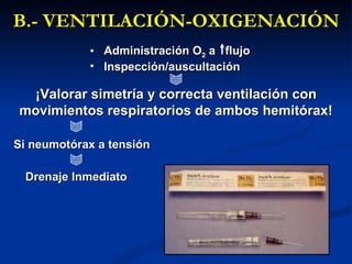 B.- VENTILACIÓN-OXIGENACIÓN Administración O 2  a  flujo  Inspección/auscultación ¡Valorar simetría y correcta ventilación con movimientos respiratorios de ambos hemitórax! Si neumotórax a tensión Drenaje Inmediato 