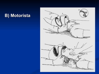 B) Motorista 