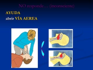 NO responde… (inconsciente) AYUDA abrir  VÍA AEREA 