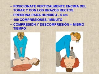 – POSICIONATE VERTICALMENTE ENCIMA DEL
TORAX Y CON LOS BRAZOS RECTOS
– PRESIONA PARA HUNDIR 4 - 5 cm
– 100 COMPRESIONES / MINUTO
– COMPRESIÓN Y DESCOMPRESIÓN = MISMO
TIEMPO
 