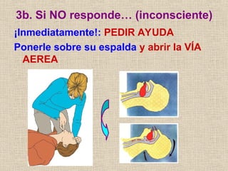 3b. Si NO responde… (inconsciente)
¡Inmediatamente!: PEDIR AYUDA
Ponerle sobre su espalda y abrir la VÍA
AEREA
 