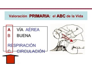 Valoración PRIMARIAPRIMARIA: el ABCABC de la Vida
A VÍA AÉREA
B BUENA
RESPIRACIÓN
C CIRCULACIÓN
 
