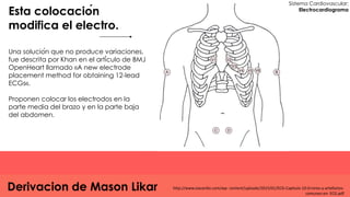 Sistema Cardiovascular:
Electrocardiograma
Derivacion de Mason Likar
Esta colocación
modifica el electro.
Una solución q...