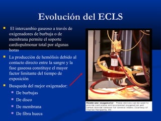 Evolución del ECLS
 El intercambio gaseoso a través de
oxigenadores de burbuja o de
membrana permite el soporte
cardiopul...