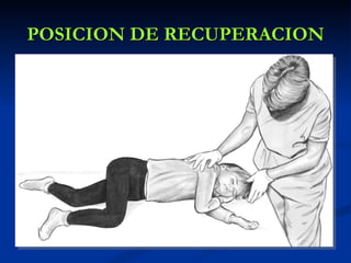 POSICION DE RECUPERACION
 