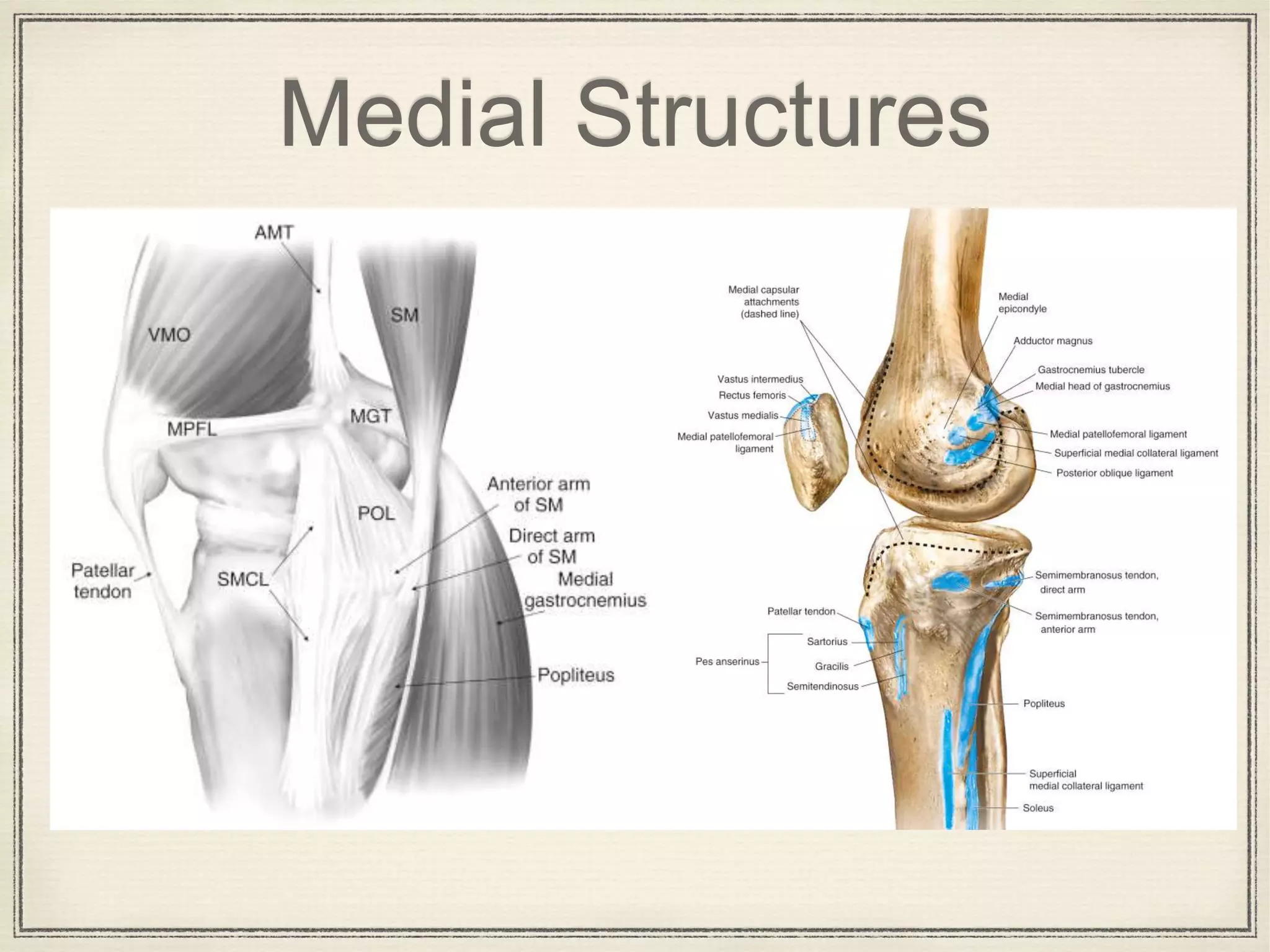 Varus Def Correcting Varus Deformity of the Knee in Total Knee Replacement | PPTX