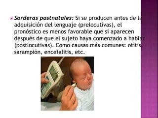  Sorderas postnatales: Si se producen antes de la
adquisición del lenguaje (prelocutivas), el
pronóstico es menos favorable que si aparecen
después de que el sujeto haya comenzado a hablar
(postlocutivas). Como causas más comunes: otitis,
sarampión, encefalitis, etc.
 