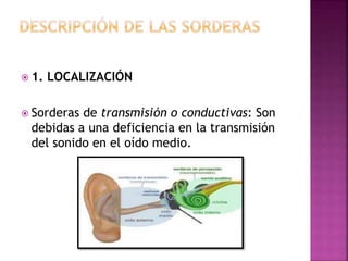  1. LOCALIZACIÓN
 Sorderas de transmisión o conductivas: Son
debidas a una deficiencia en la transmisión
del sonido en el oído medio.
 