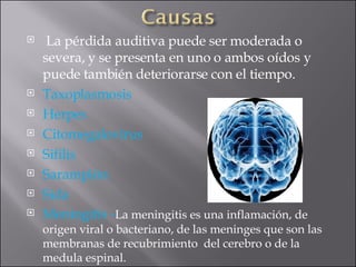 La pérdida auditiva puede ser moderada o severa, y se presenta en uno o ambos oídos y puede también deteriorarse con el tiempo.  Taxoplasmosis Herpes Citomegalovirus Sifilis Sarampión Sida Meningitis - La meningitis es una inflamación, de origen viral o bacteriano, de las meninges que son las membranas de recubrimiento  del cerebro o de la medula espinal.  