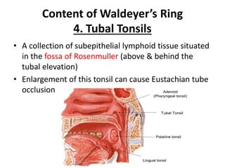 Content of Waldeyer’s Ring
4. Tubal Tonsils
• A collection of subepithelial lymphoid tissue situated
in the fossa of Rosenmuller (above & behind the
tubal elevation)
• Enlargement of this tonsil can cause Eustachian tube
occlusion
 