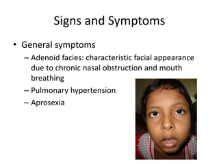 Signs and Symptoms
• General symptoms
– Adenoid facies: characteristic facial appearance
due to chronic nasal obstruction and mouth
breathing
– Pulmonary hypertension
– Aprosexia
 