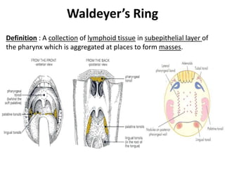 Waldeyer’s Ring
Definition : A collection of lymphoid tissue in subepithelial layer of
the pharynx which is aggregated at places to form masses.
 