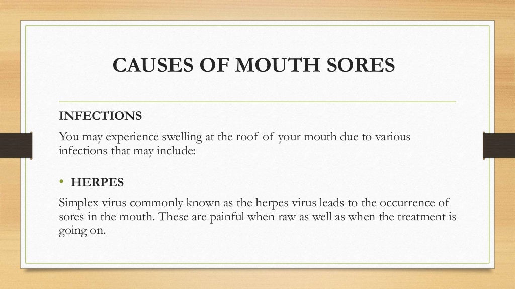 SORES & SWELLING AT ROOF OF MOUTH