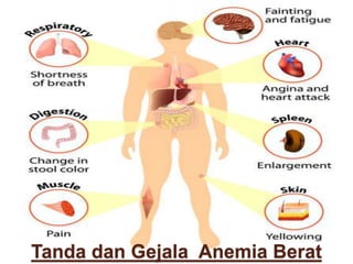Tanda dan Gejala Anemia Berat
 
